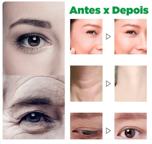 Sérum Facial 12Em1 - Retinol + Hialurônicos  [SEMANA DO CONSUMIDOR]
